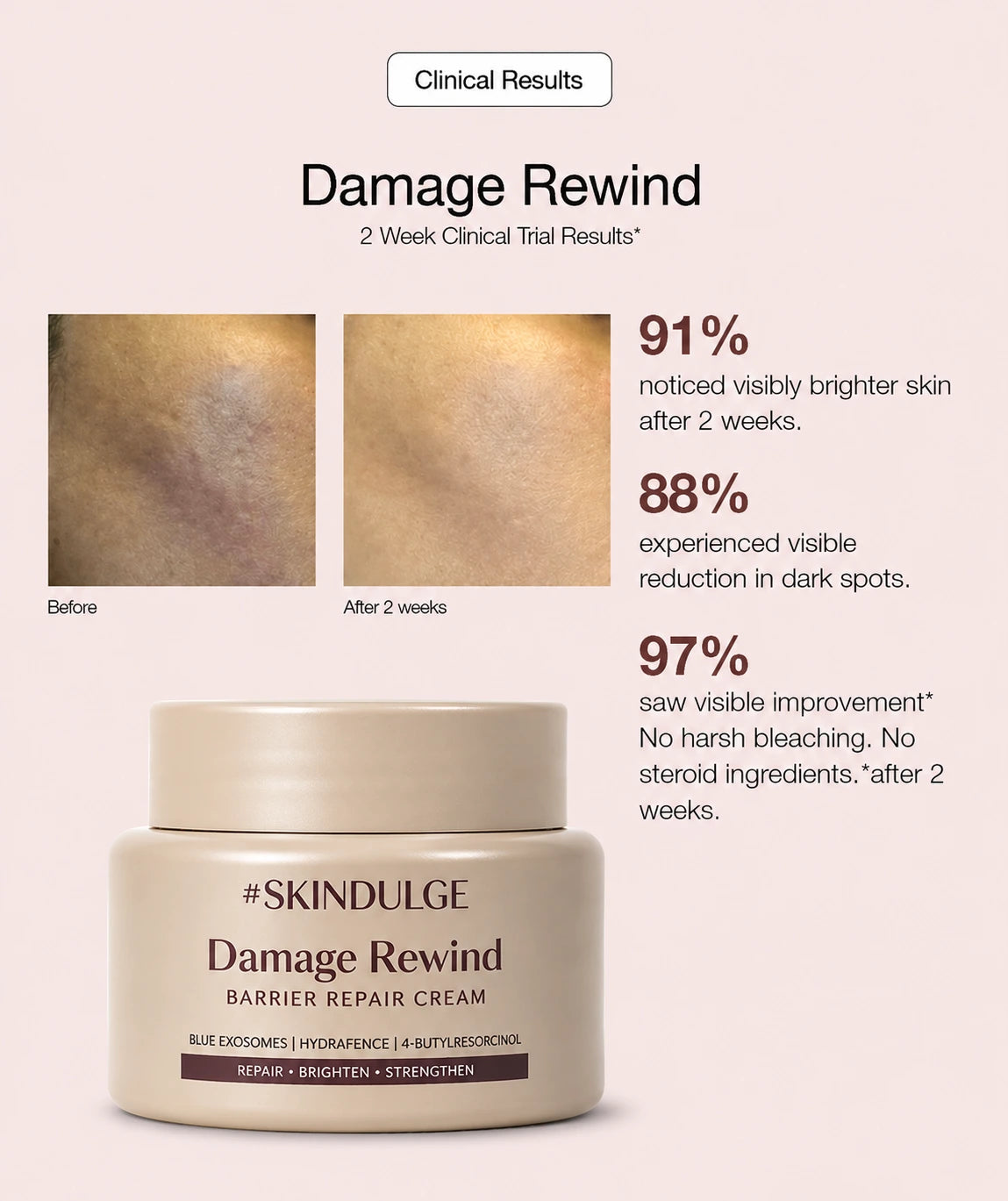 Damage Rewind - Skin Dulge