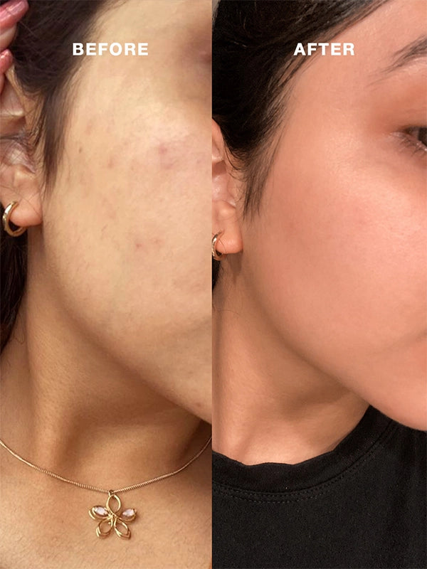 Before After Result